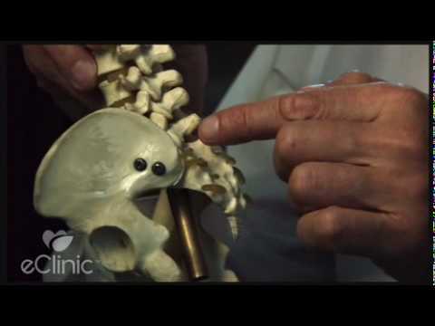 Diagnosing Back Pain