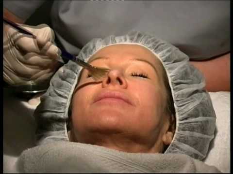 AHA Lactic Acid Peel - Anti ageing Skin Rejuvenation