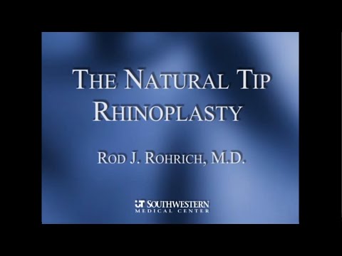 4 The Natural Tip Rhinoplasty