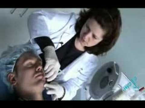Microdermabrasion - Procedures