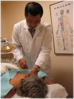 acupuncture treatment