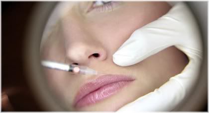 collagen injection lip