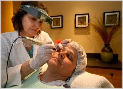 laser skin treatment