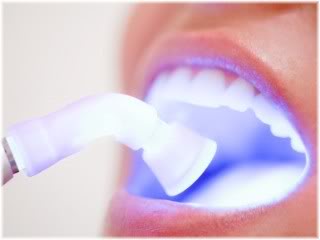 tongue laser treatment