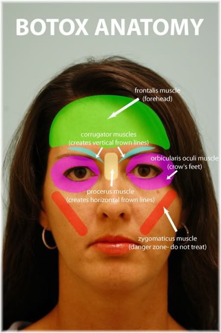 Botox facial muscles