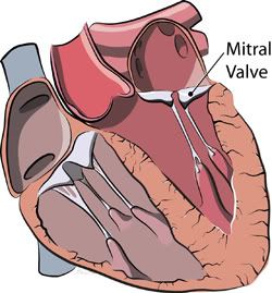 mitral valve