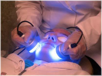 blue laser light acne treatment