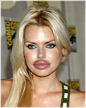 woman with large lips