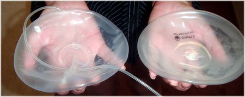 deflated saline implant
