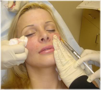 woman facial injection